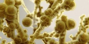 Surto de Superfungo atinge Hospital da Bahia