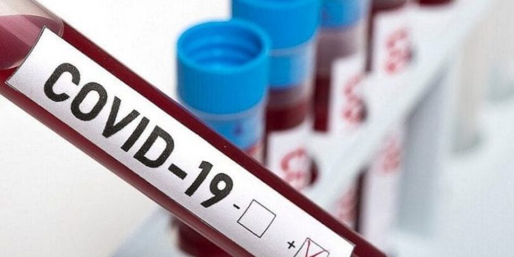 Bahia volta a apresentar alta de casos do covid 19