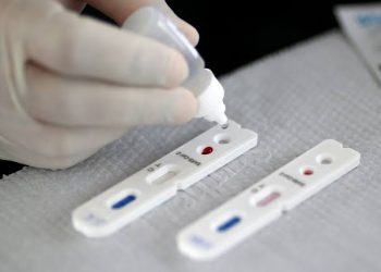 Madre de Deus realiza força tarefa de testagem rápida da covid 19