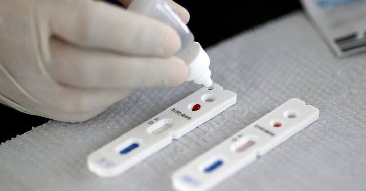 Madre de Deus realiza força tarefa de testagem rápida da covid 19