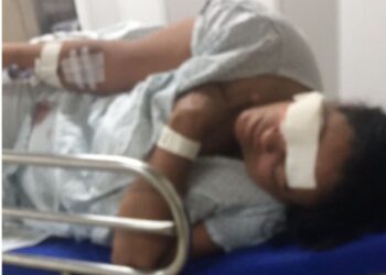 Camaçari: Mulher tem pedaço do rosto arrancado pelo próprio marido