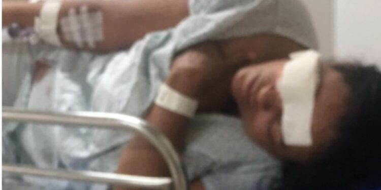 Camaçari: Mulher tem pedaço do rosto arrancado pelo próprio marido