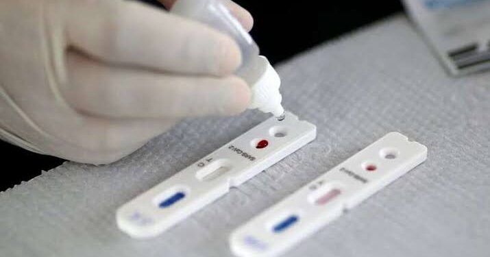 Após Réveillon, novas infecções por Covid-19 crescem cerca de 270% em Salvador