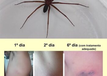 Salvador: Mulher é internada após ser picada por aranha