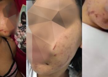 Feira de Santana: Jovem de 16 anos é espancada pelo namorado e não consegue medida protetiva