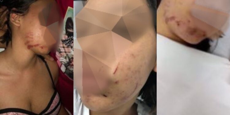 Feira de Santana: Jovem de 16 anos é espancada pelo namorado e não consegue medida protetiva