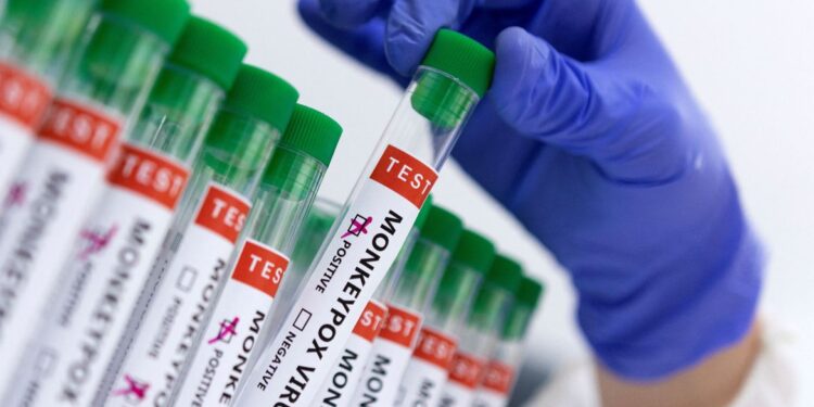 São Paulo confirma segundo caso de varíola dos macacos