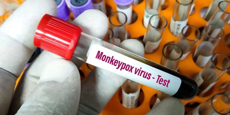 OMS declara varíola dos macacos emergência internacional de saúde