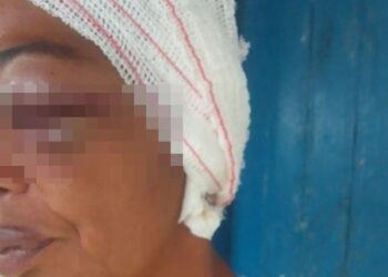 Mulher é agredida e tem orelha arrancada por filho e nora na Bahia