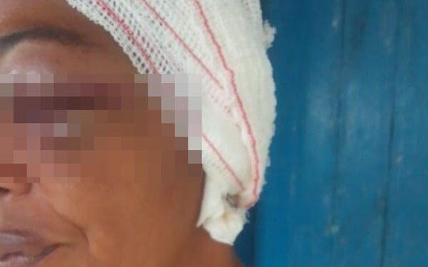 Mulher é agredida e tem orelha arrancada por filho e nora na Bahia