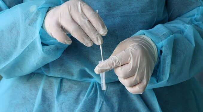 Infectologista afirma que a Covid-19 não vai nos deixar; a subvariante da Ômicron é a continuação da doença