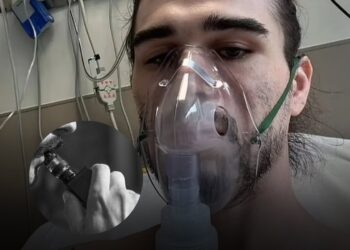 Jovem de 22 anos tem pulmão perfurado pelo uso de vape