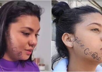 Um ano após ter rosto tatuado à força pelo ex, jovem segue tentando remover tatuagem