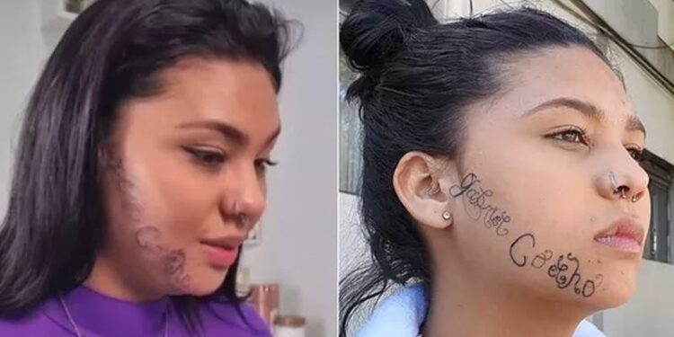 Um ano após ter rosto tatuado à força pelo ex, jovem segue tentando remover tatuagem