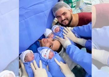 Mulher investiga tumor, descobre gravidez e dá à luz quadrigêmeos