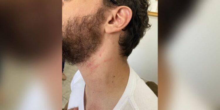 Delegado entra armado na escola do filho e agride professor