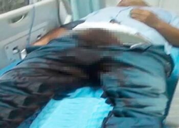 Homem em momento de surto, corta o próprio pênis e joga no vaso