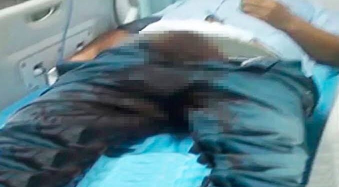 Homem em momento de surto, corta o próprio pênis e joga no vaso