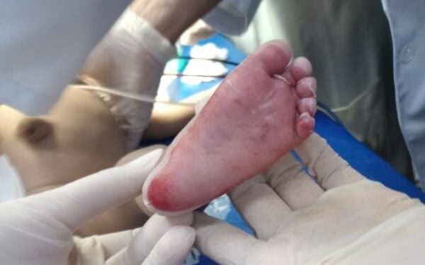 Mãe e pai são suspeitos de torturar bebê de 3 meses até a morte