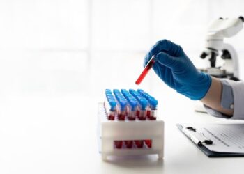 Exame de sangue que detecta alzheimer chega ao Brasil