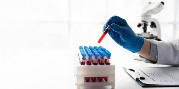 Exame de sangue que detecta alzheimer chega ao Brasil