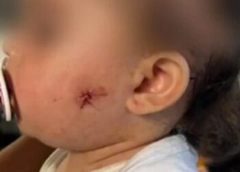 PM atira no rosto de bebê de 1 ano , criança está internada