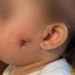 PM atira no rosto de bebê de 1 ano , criança está internada
