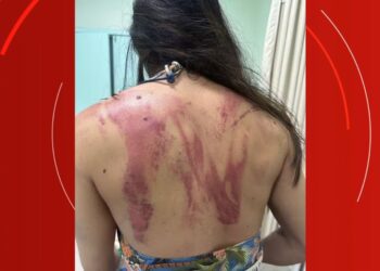 “Pensei q seria meu último dia”, diz mulher que quase foi morta pelo próprio pai