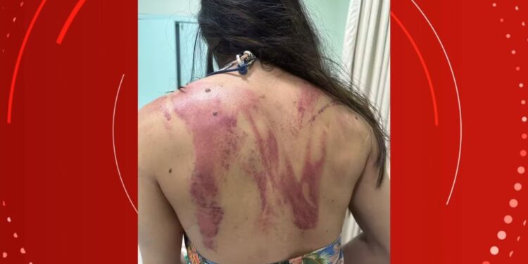 “Pensei q seria meu último dia”, diz mulher que quase foi morta pelo próprio pai