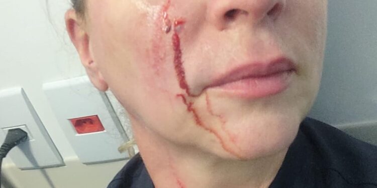 Violência contra médicos sobe 68% em dez anos; enfermeiros também são vítimas