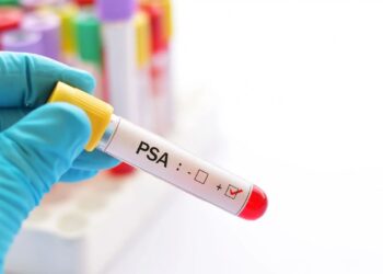 Novembro Azul: Prefeitura de Camdeias divulga cronograma para exames de PSA nas Unidades de Saúde