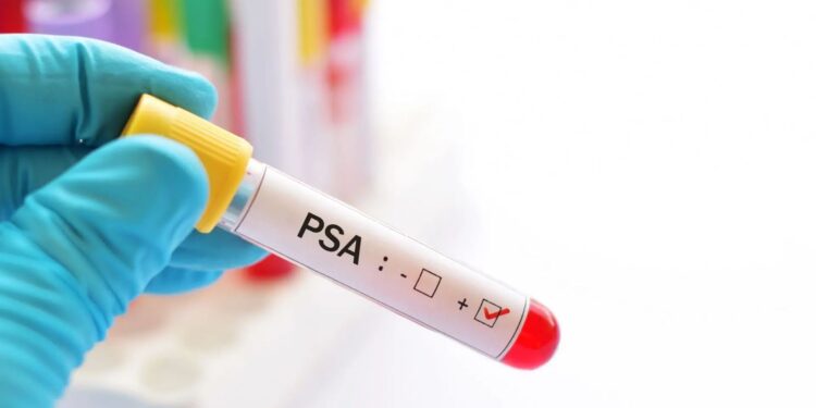 Novembro Azul: Prefeitura de Camdeias divulga cronograma para exames de PSA nas Unidades de Saúde